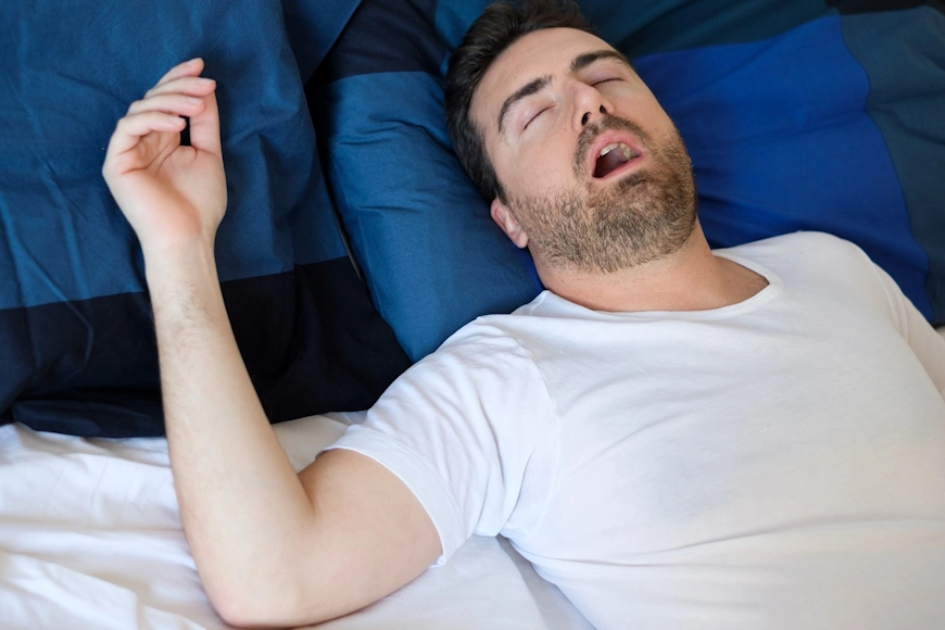 Can GDental Help You Manage Sleep Apnea? The Role of Oral Appliances