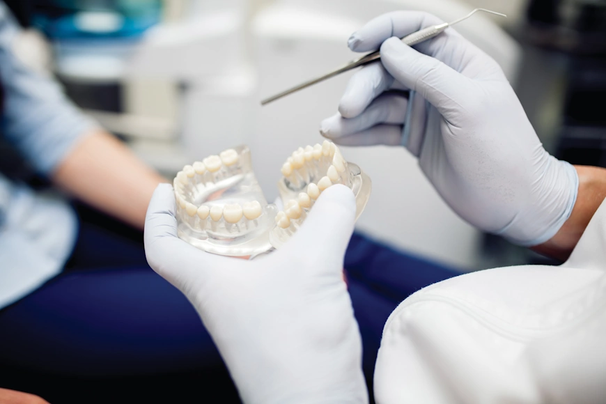 How Long Do Dental Crowns Last? Unveiling the Facts at GDental