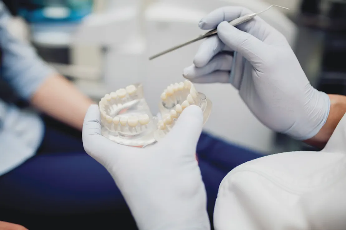 How Long Do Dental Crowns Last? Unveiling the Facts at G Dental