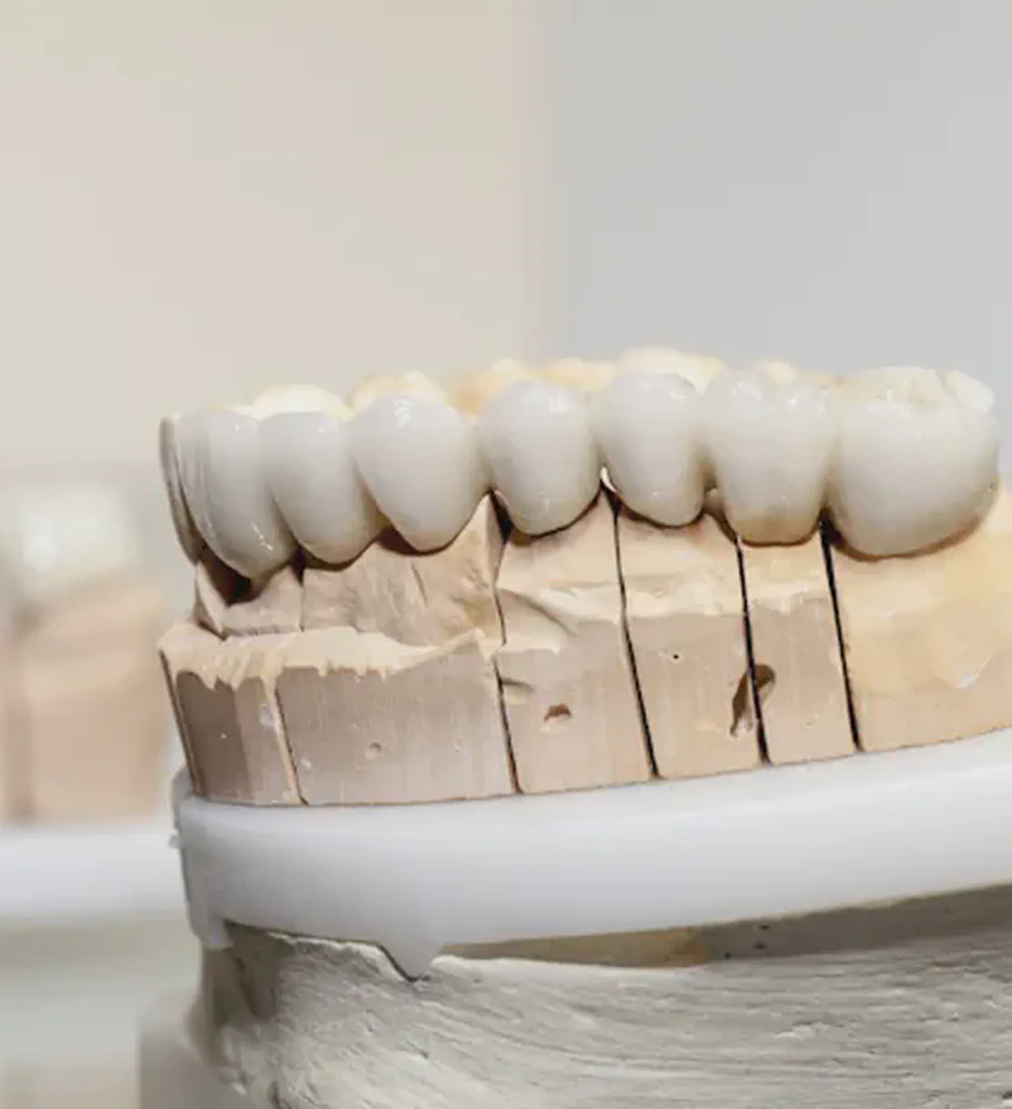 Dentures