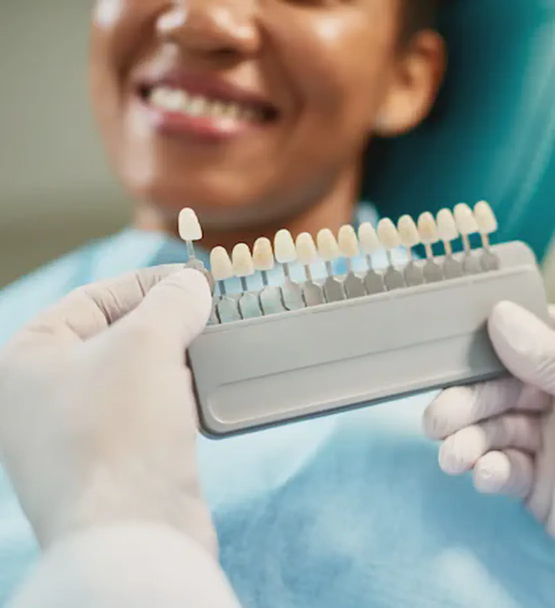 Teeth Whitening